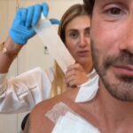 Stefano De Martino, cancellato un altro tatuaggio dedicato a Belen