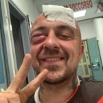Roma, Chef Rubio presenta denuncia dopo aggressione
