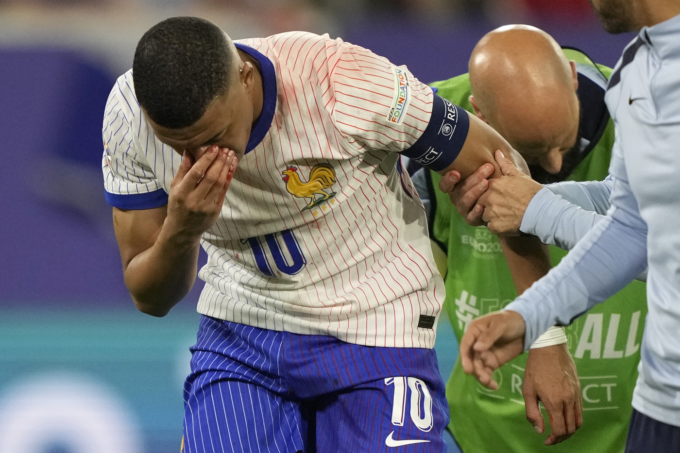 Euro 2024, Mbappé si rompe il naso in Austria-Francia: scongiurato l’intervento
