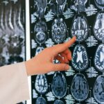 Salute mentale, identificata area cerebrale che inibisce paura e ansia