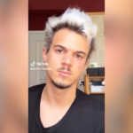 Torino, aggredito l’influencer Pietro Morello: sui social mostra i lividi