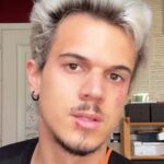 Torino, aggredito musicista Pietro Morello: “E’ perché ho detto fascisti?”