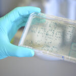 Escherichia Coli: cos’è, sintomi e come si trasmette