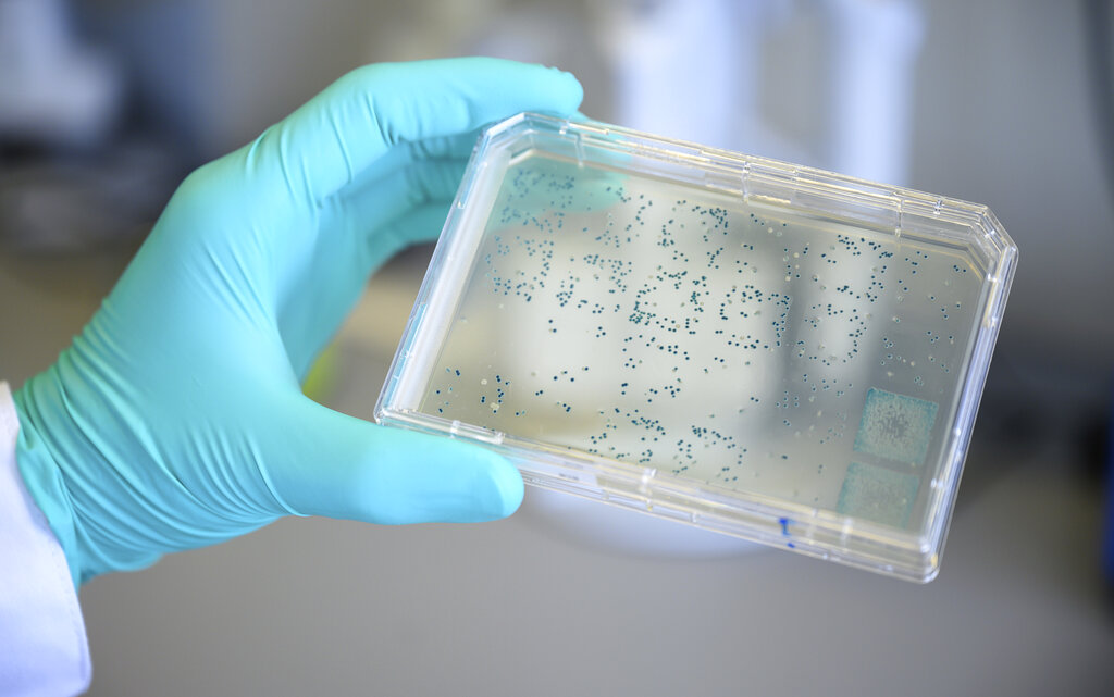 Escherichia Coli: cos’è, sintomi e come si trasmette Escherichia Coli: cos’è, sintomi e come si trasmette