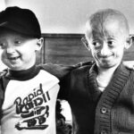 Progeria, cos’è la malattia di Sammy Basso che causa l’invecchiamento precoce