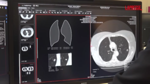 Salute, Ebit lancia a Berlino la piattaforma per imaging diagnostico Suitestensa Zefiro