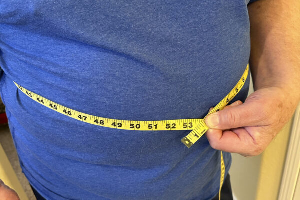 Obesità, cambiano gli indici per la diagnosi: non solo il Bmi