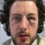 Torino, aggressione omofoba denunciata sui social