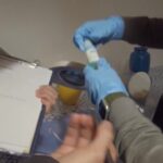 Bergamo, falso medico eseguiva interventi estetici: denunciata