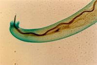 Il parassita Angiostrongylus cantonensis, trasmesso dalle lumache con 93 casi confermati in Australia dal 2020