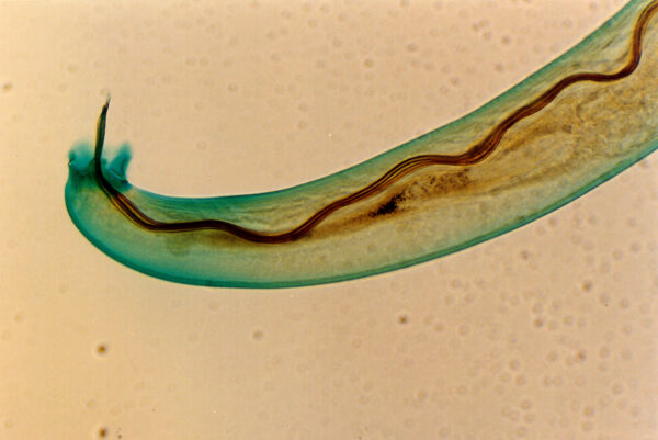 Il parassita Angiostrongylus cantonensis, trasmesso dalle lumache con 93 casi confermati in Australia dal 2020