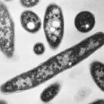 Legionella a Milano, un morto e 4 ricoverati