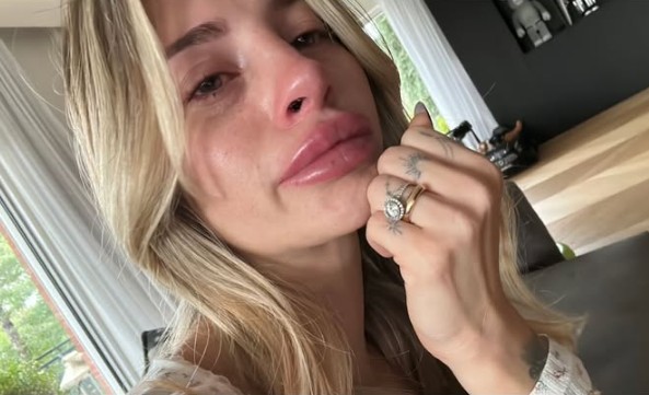 Chiara Nasti in lacrime sui social: “Ho affrontato il buio, ora sto meglio” Chiara Nasti in lacrime sui social: “Ho affrontato il buio, ora sto meglio”