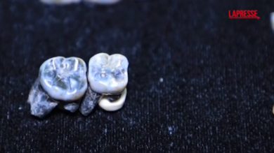 Etiopia, trovati 10 denti di Australopithecus risalenti a due milioni di anni fa