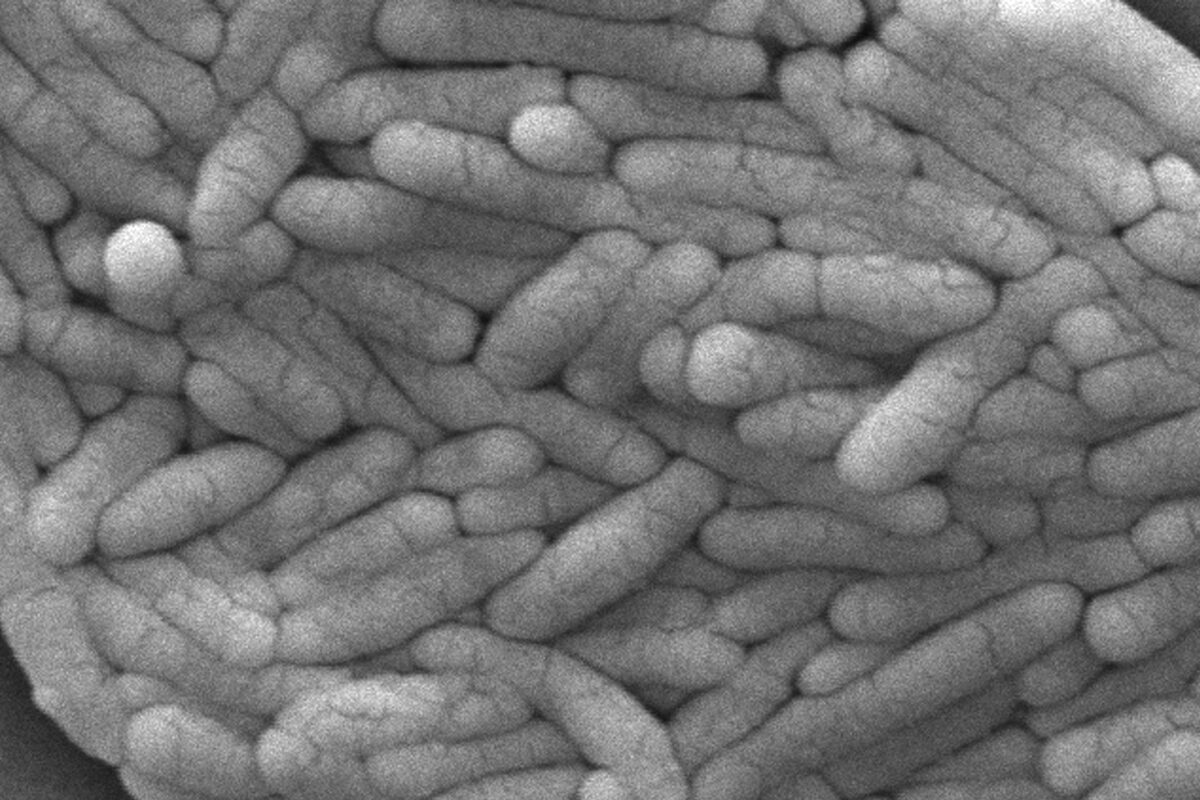 salmonella in spagna 100 intossicati in hotel a murcia