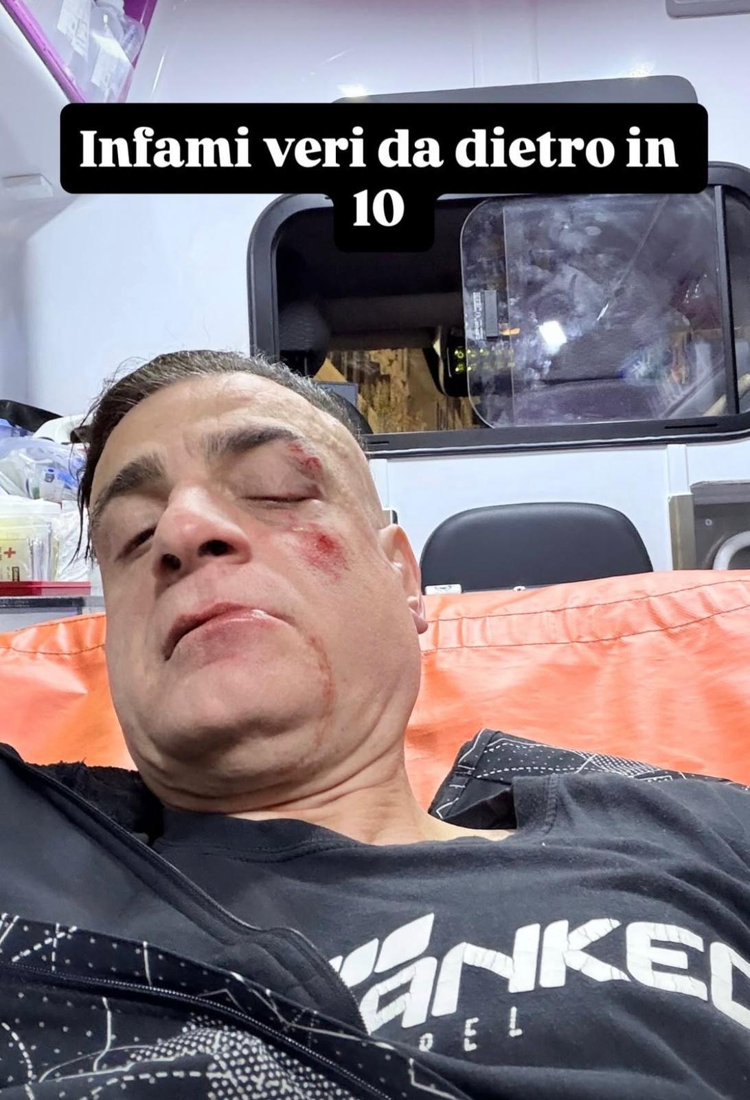 Cicalone, lo youtuber aggredito dai borseggiatori sulla metro a Roma: “Infami veri”