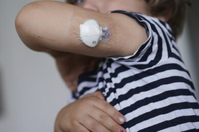 Diabete di tipo 1, verso una soluzione per bimbi sotto gli 8 anni