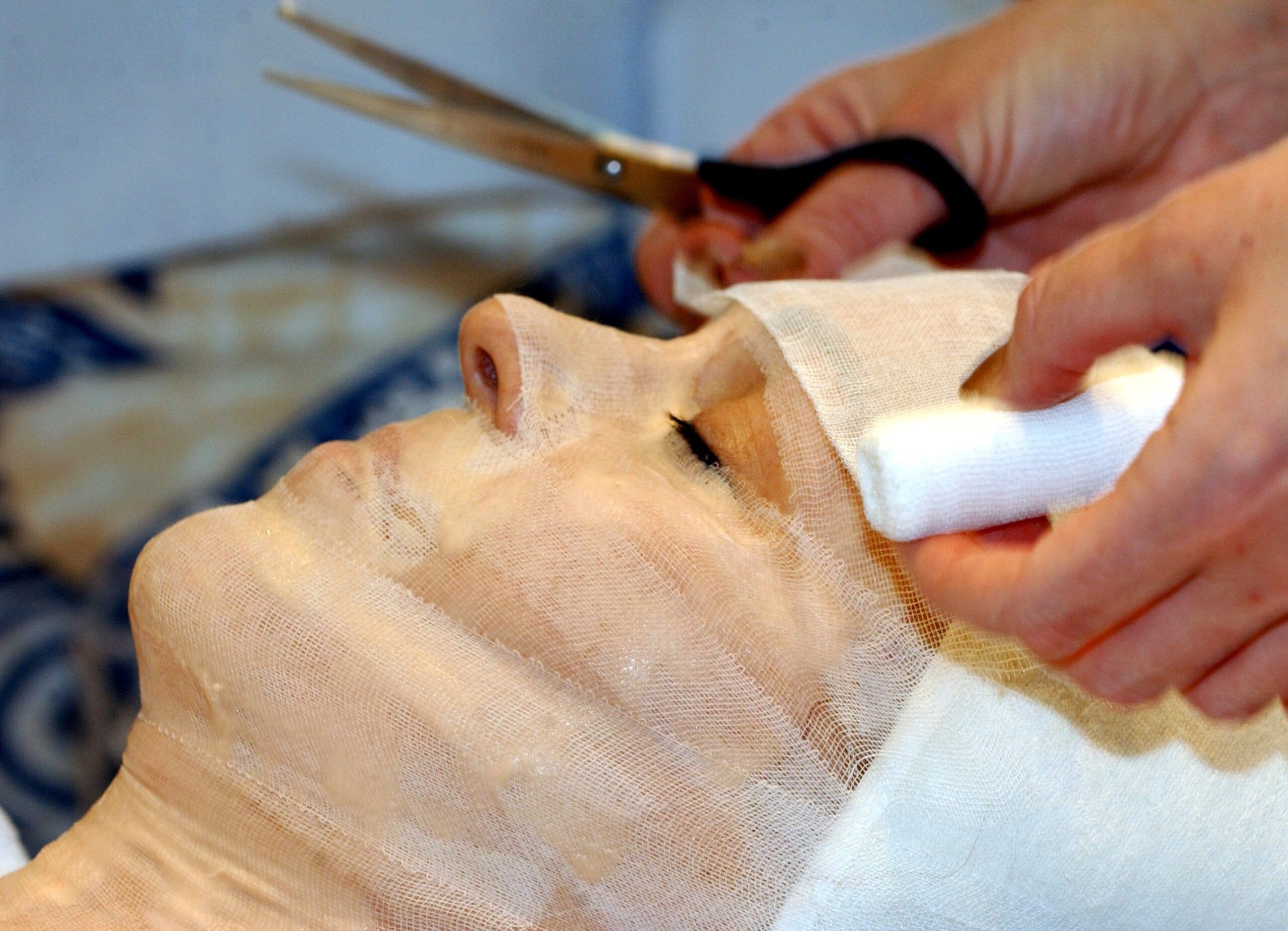 Crans-Montana: da dove arriva la pelle per ‘curare’ le grandi ustioni 