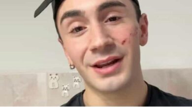 Genova, 19enne denuncia aggressione omofoba: “Sfregiato al viso”