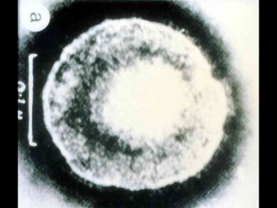 Encefalite da virus dell’herpes simplex, la mossa di Alfasigma