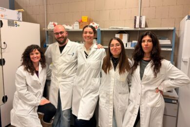 Digiuno intermittente: ecco perché fa bene al cervello