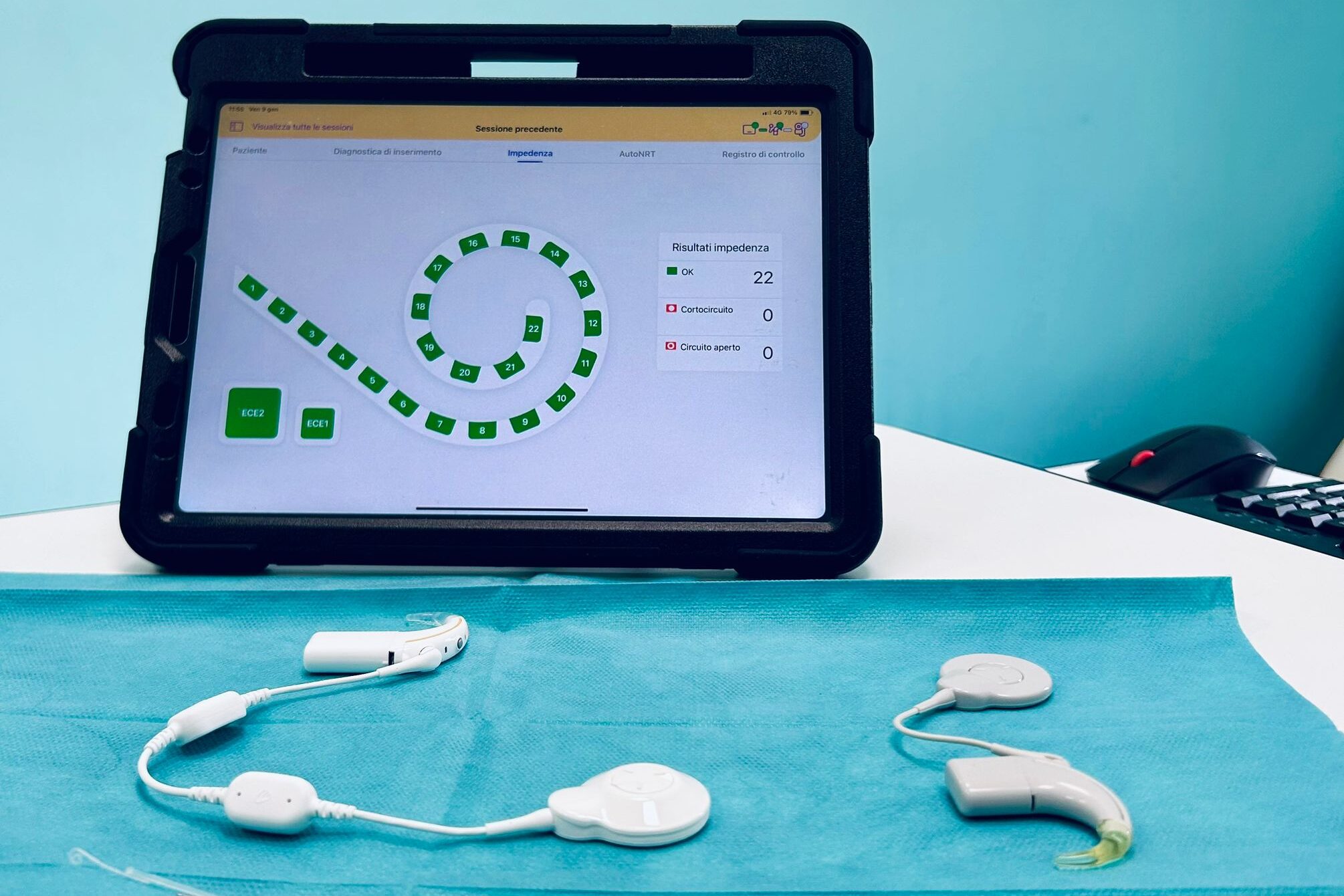 Udito, a Bari primo impianto cocleare smart bambino di 11 anni