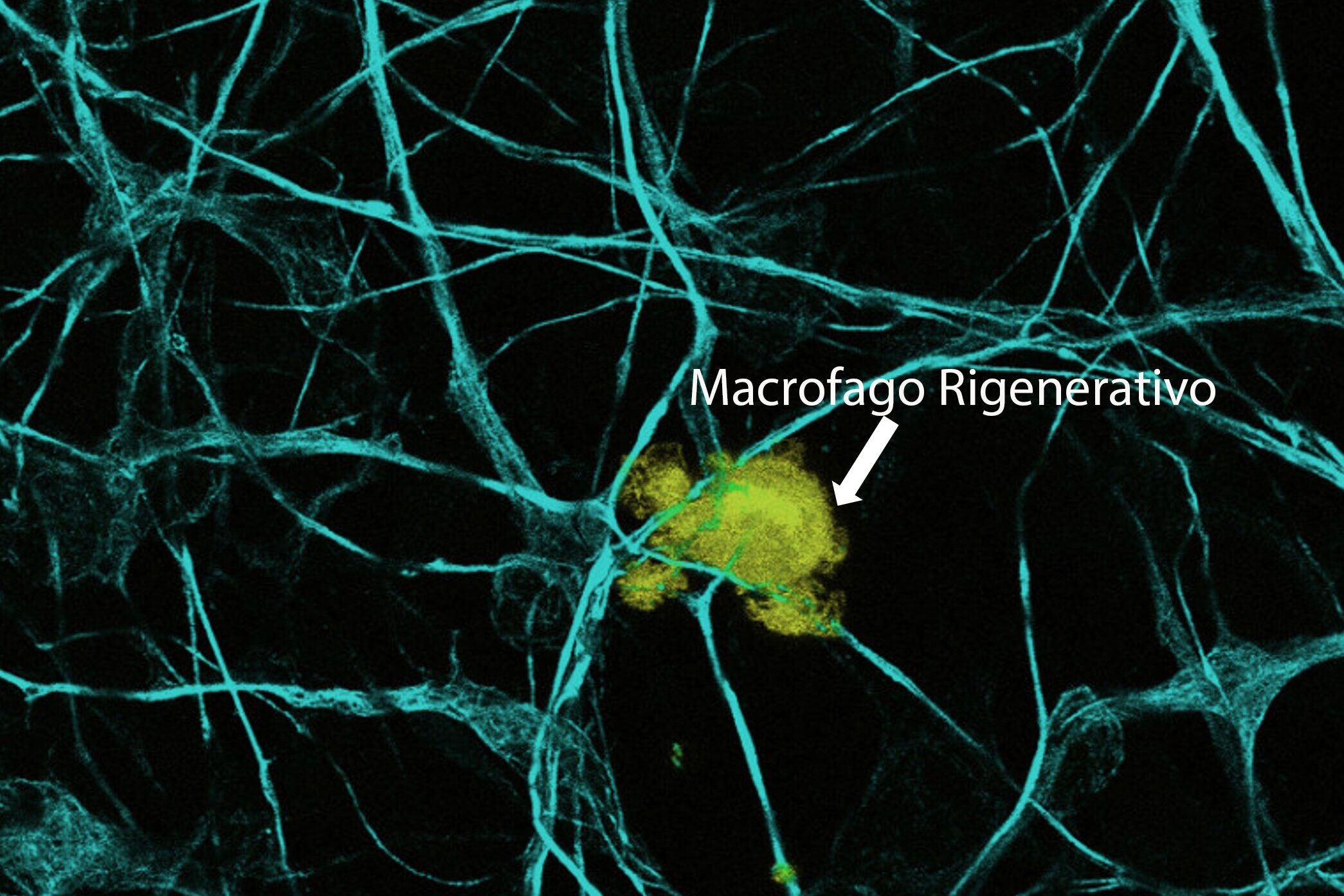 Midollo spinale rigenerato con l’aiuto di cellule alleate del tumore, la scoperta Midollo spinale rigenerato con l’aiuto di cellule alleate del tumore, la scoperta
