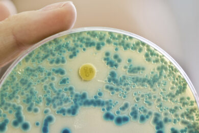 Che cos’è la meningite tubercolare che ha colpito la bimba ricoverata a Bologna