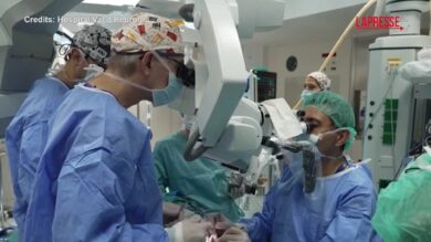Spagna, sorprendente trapianto di faccia da donatrice morta per eutanasia