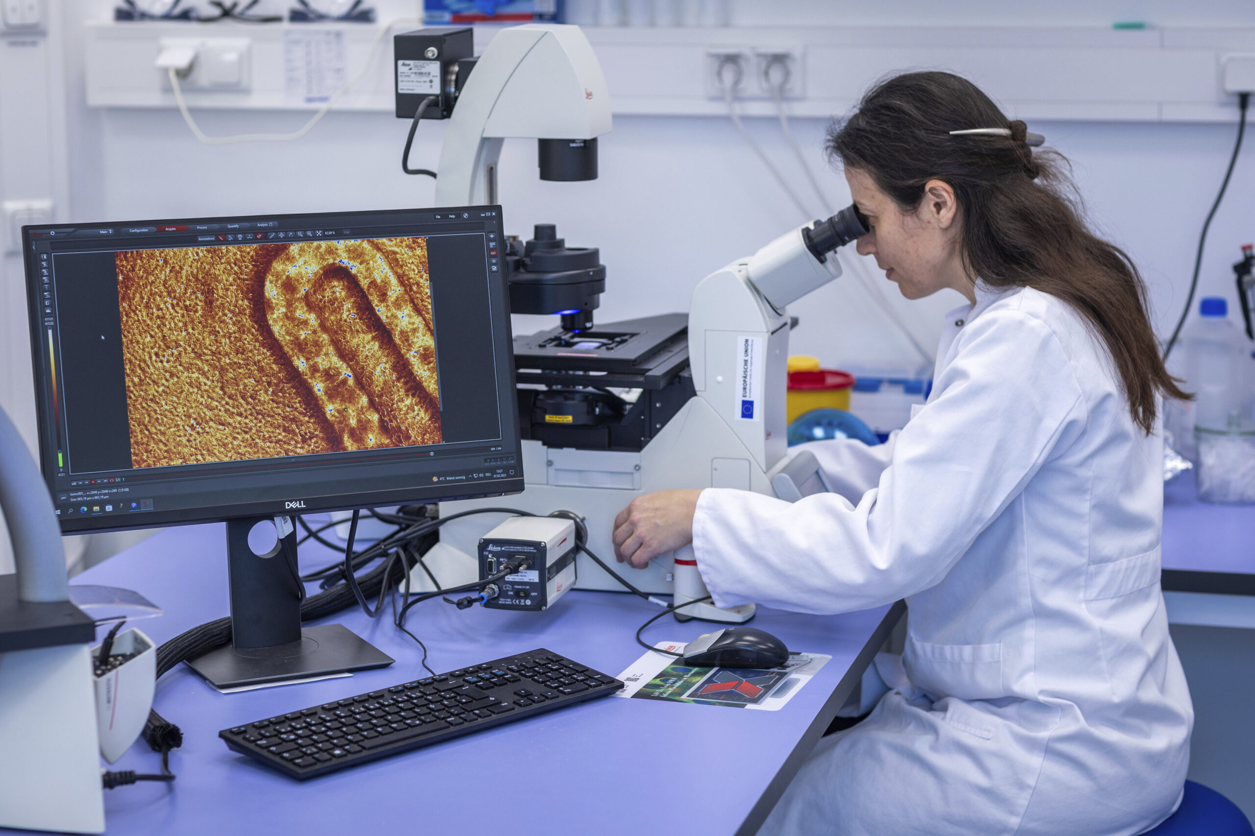 Tumori e metabolismo lipidico: individuato possibile bersaglio terapeutico