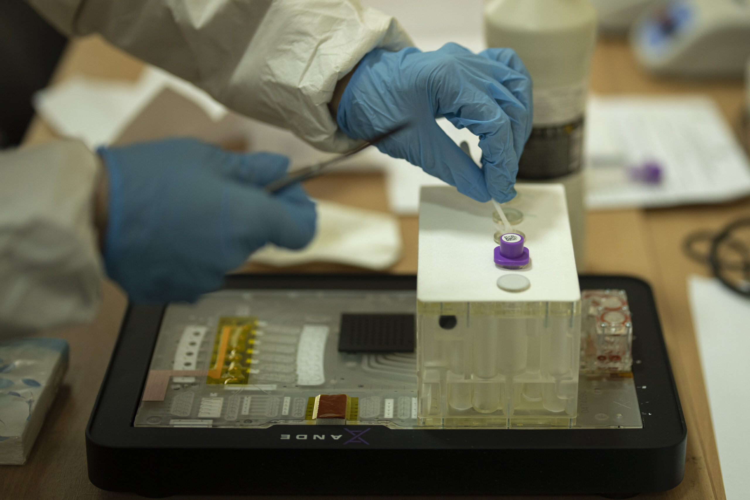 Nel Dna dei sardi un’indizio contro la malaria: la scoperta 