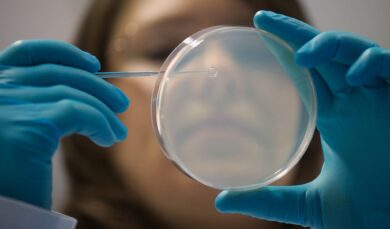 Cellule staminali contro il Parkinson, l’annuncio in Giappone e a che punto è la ricerca