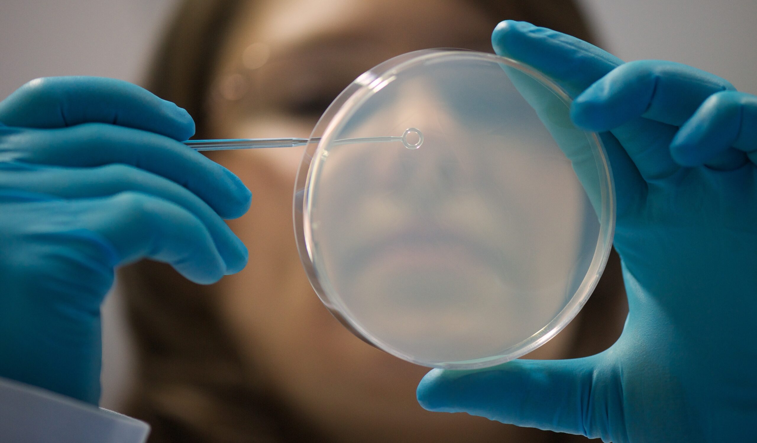 Cellule staminali contro il Parkinson, l’annuncio in Giappone e a che punto è la ricerca