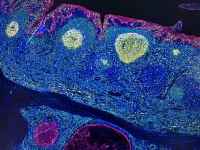 La ‘notte stellata’ dell’immunoterapia: dentro il nuovo laboratorio del Crom guidato dal team di Paolo Ascierto