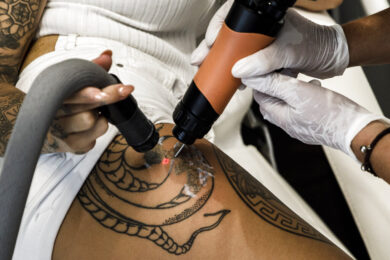 Non basta ‘fare il laser’, alla scoperta dei benefici (e dei rischi) per la pelle