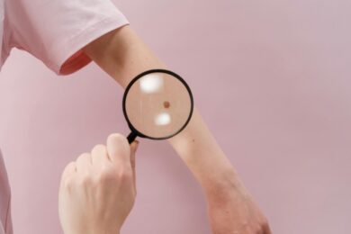 Melanoma in Italia, l’aumento dei casi e le novità della ricerca