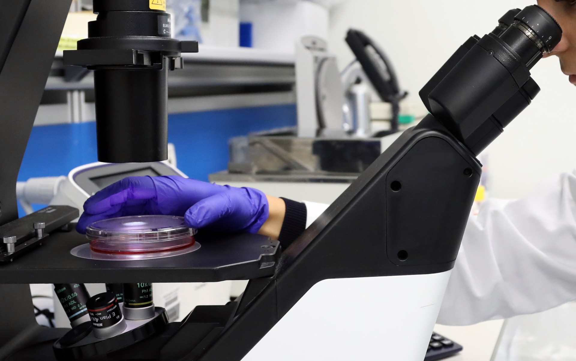 Malattia di Still, scoperta la molecola che predice decorso e complicanze Malattia di Still, scoperta la molecola che predice decorso e complicanze