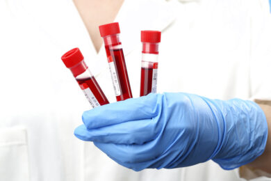 Test del sangue low cost che rileva tumori e malattie dal Dna circolante