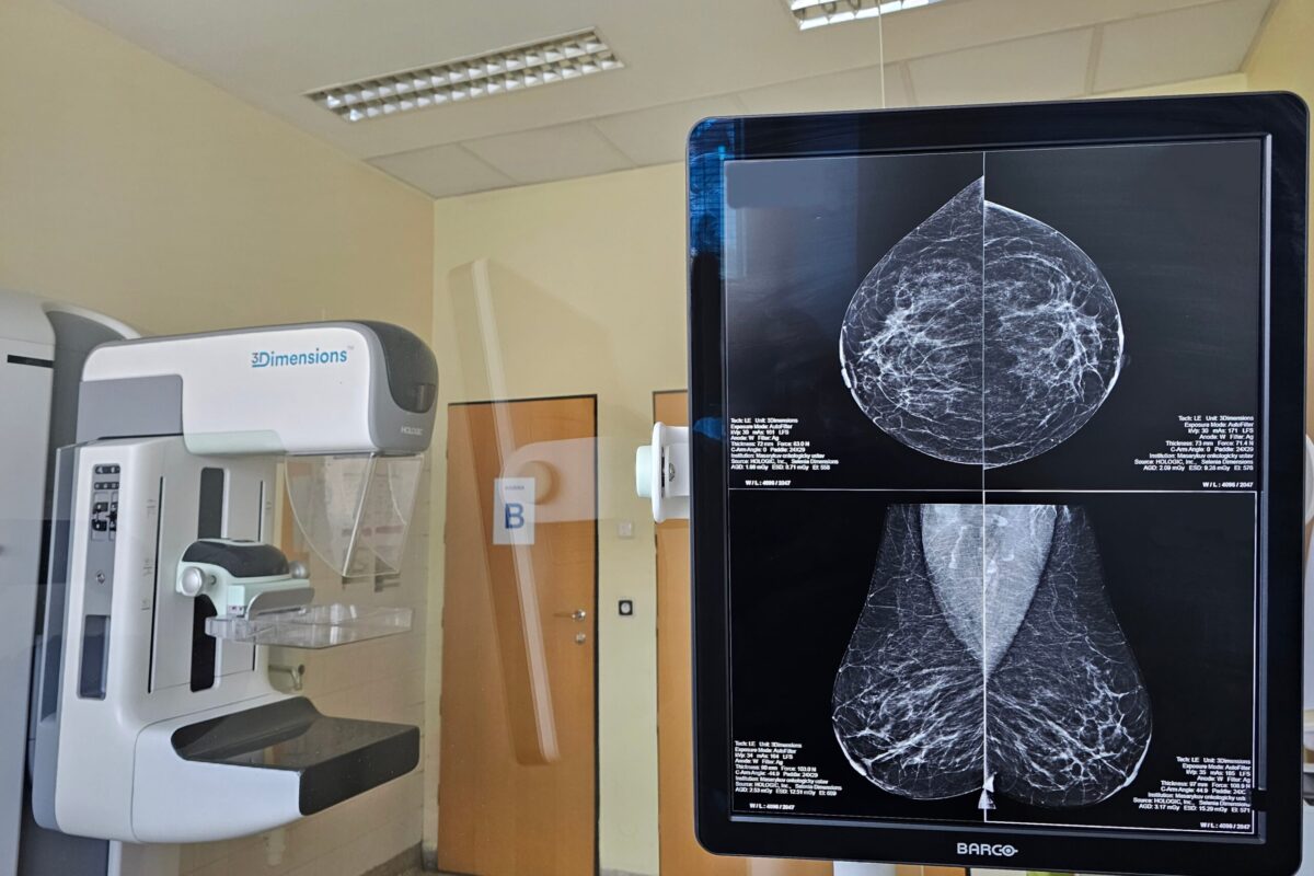 ecco l8217interruttore molecolare che frena il tumore al seno160 da Lapresse.it ecco l8217interruttore molecolare che frena il tumore al seno160