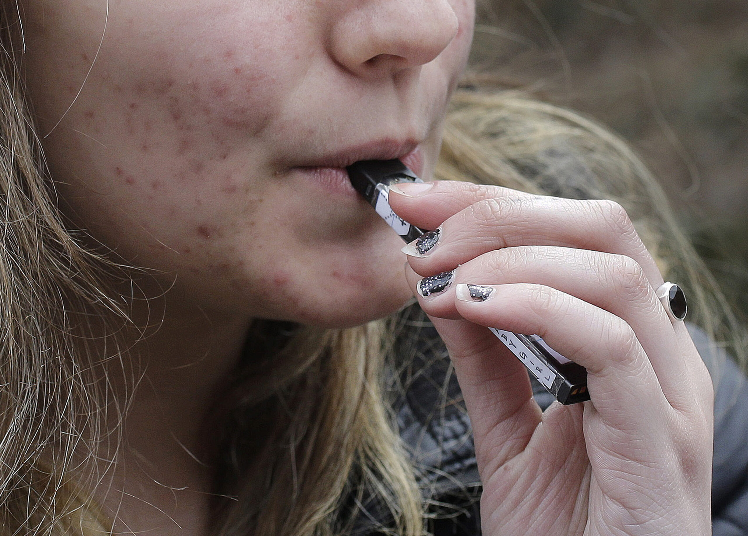 Acne tra salame e dentifricio: i falsi miti e cosa funziona davvero Acne tra salame e dentifricio: i falsi miti e cosa funziona davvero