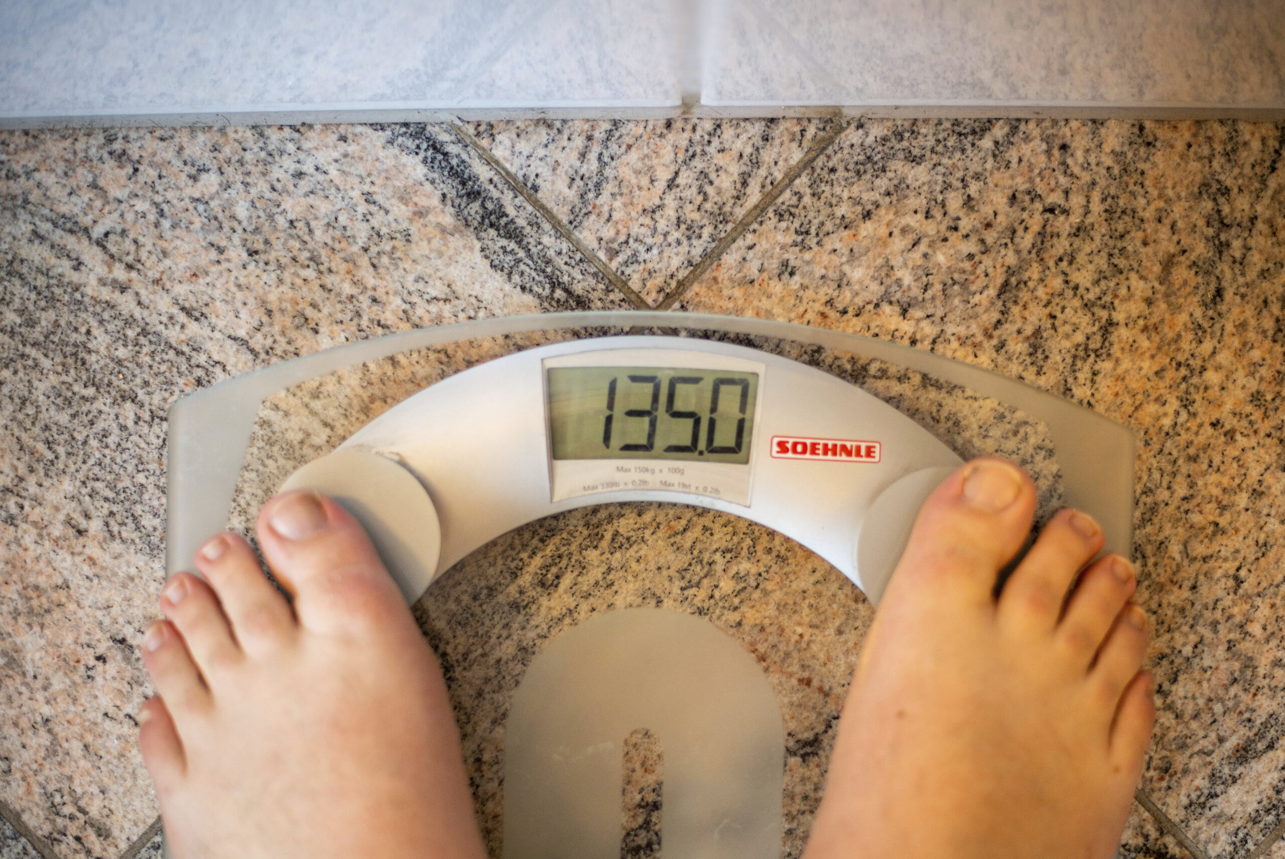 Perché l’obesità ‘metabolicamente sana’ non esiste: la ricerca Perché l’obesità ‘metabolicamente sana’ non esiste: la ricerca