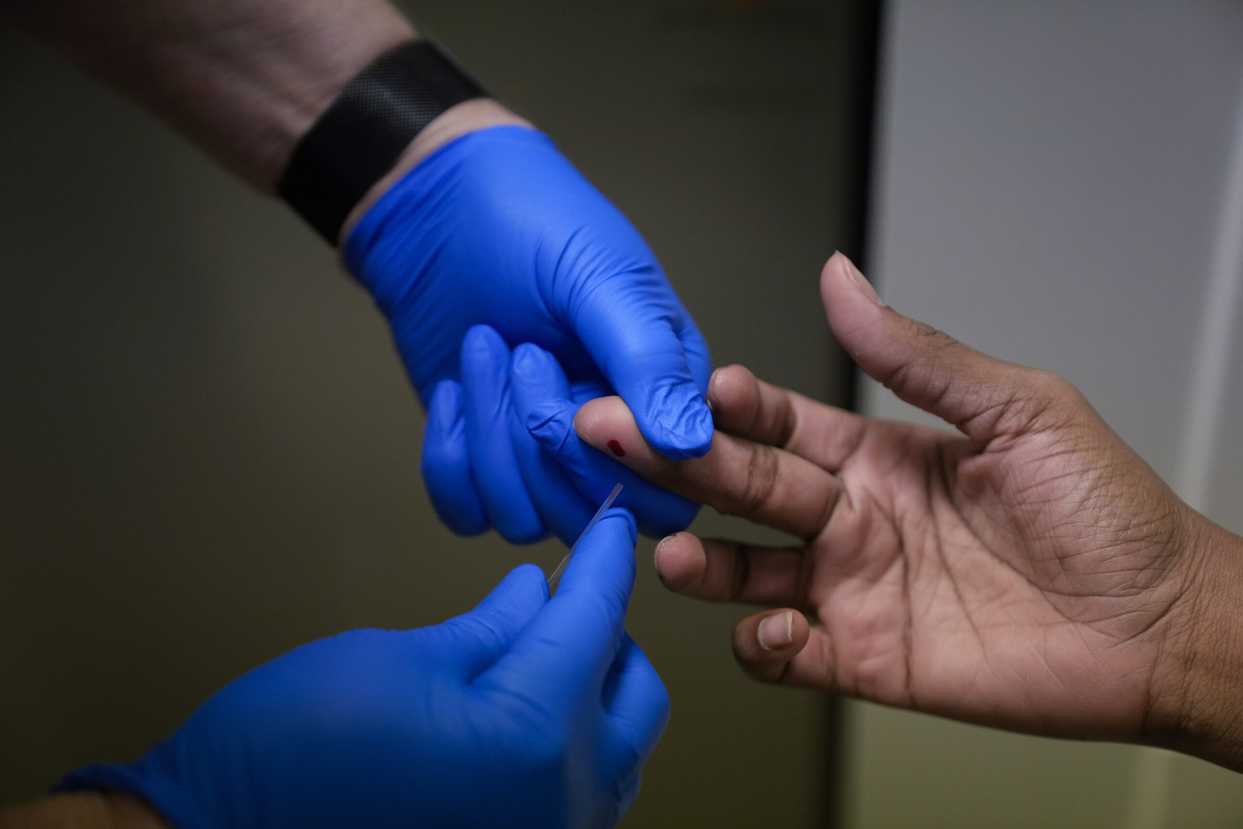 Il ‘pre-diabete’ non convince più: verso una nuova classificazione