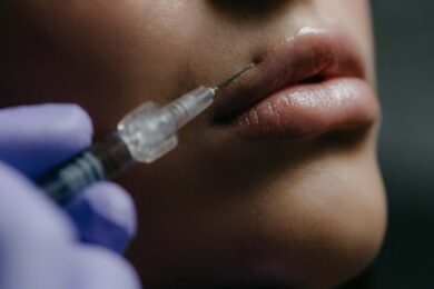 È boom di filler e botulino, ma occhio alle possibili complicanze 