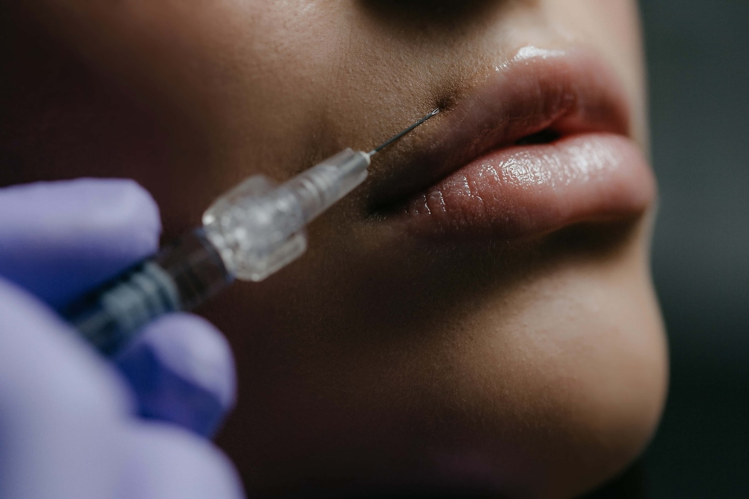 È boom di filler e botulino, ma occhio alle possibili complicanze 