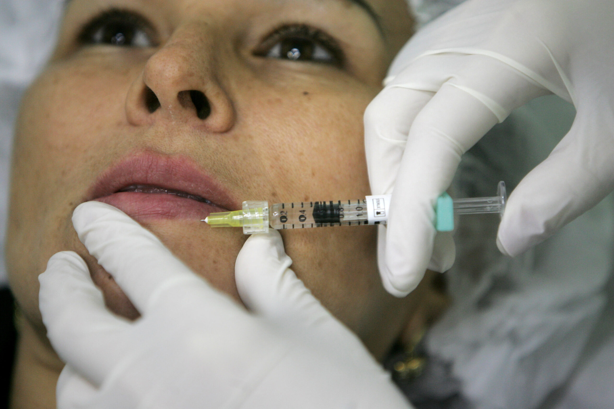 Medicina estetica oltre i volti da social, gli ultimi trend della bellezza Medicina estetica oltre i volti da social, gli ultimi trend della bellezza