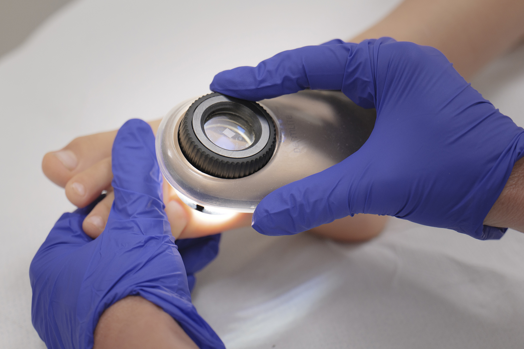 Melanoma e bambini, i numeri del rischio e i 10 errori da non fare al sole Melanoma e bambini, i numeri del rischio e i 10 errori da non fare al sole