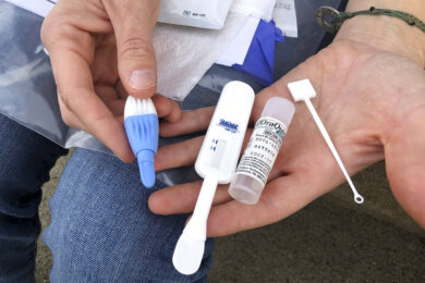 Hiv, lo stigma che colpisce le donne e i ritardi nella diagnosi