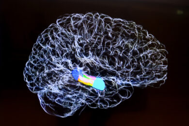 Menopausa e problemi di memoria, che succede nel cervello delle donne