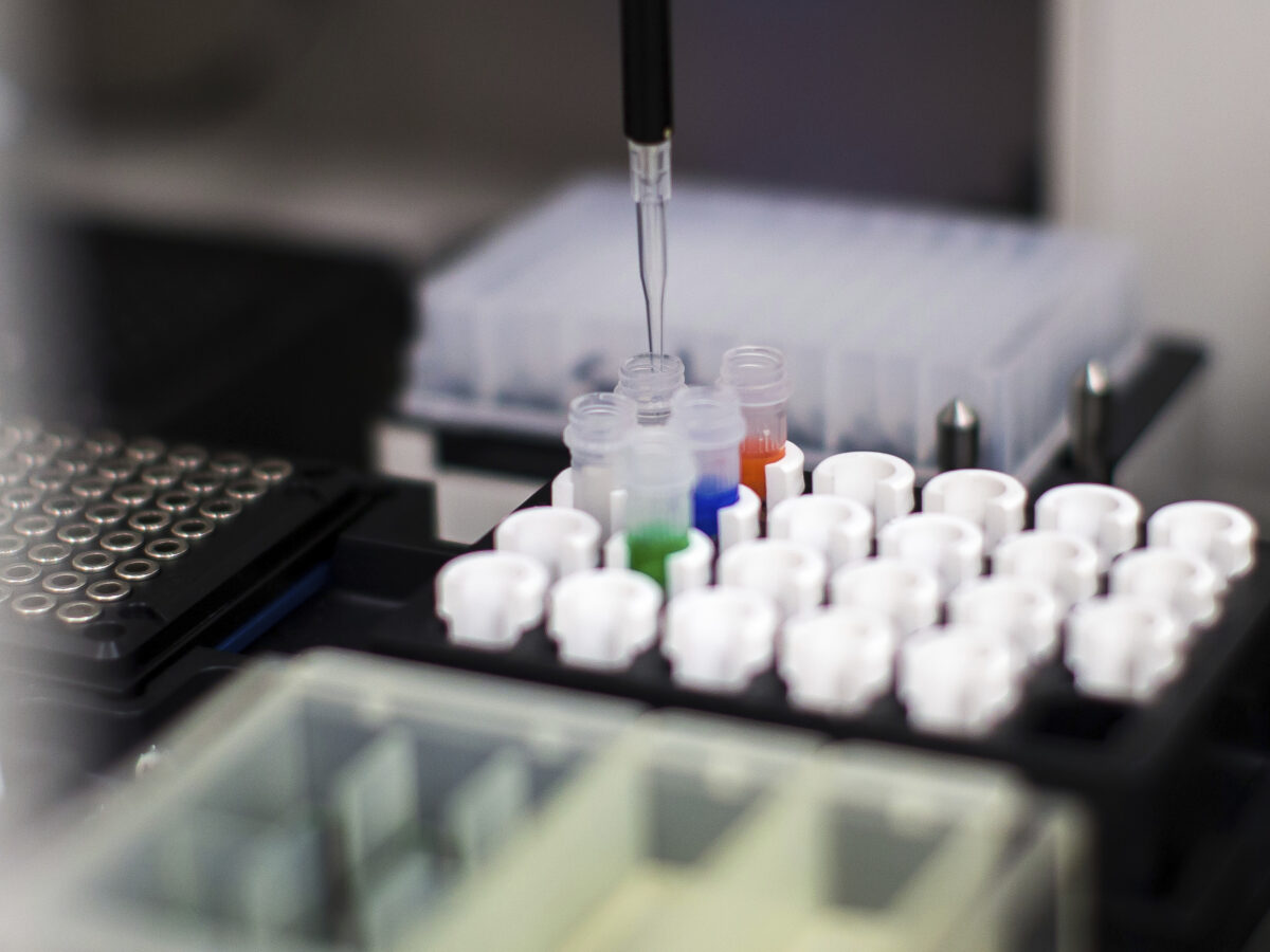 tumore al pancreas la promessa della pillola che raddoppia la sopravvivenza da Lapresse.it tumore al pancreas la promessa della pillola che raddoppia la sopravvivenza