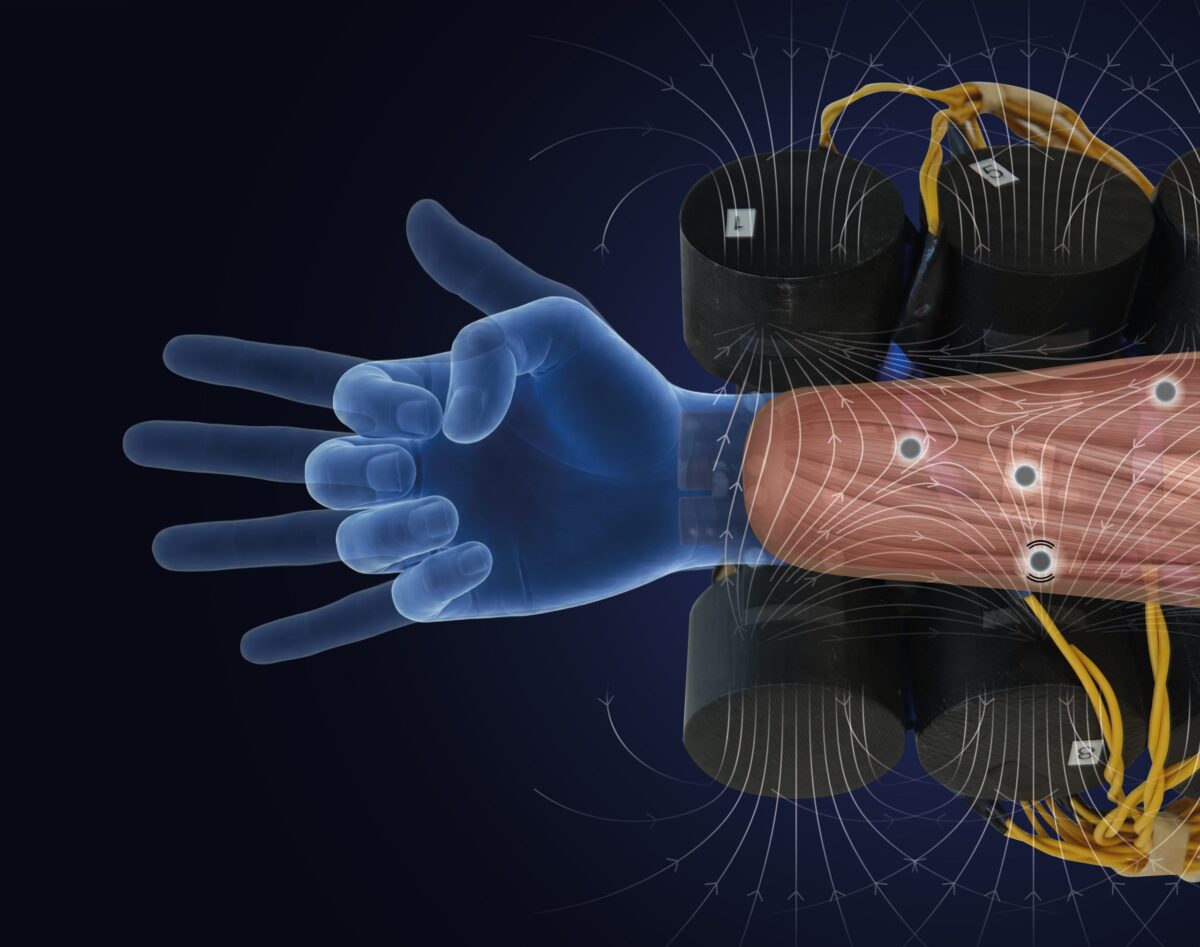 Mano robotica ‘sente’ il movimento, ecco la protesi da copertina